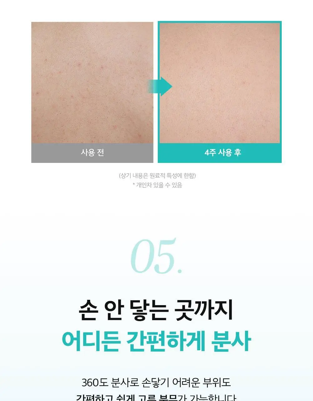 [등드름개선/흔적]더마비 AC컨트롤 바디미스트 200ml 상세페이지 25